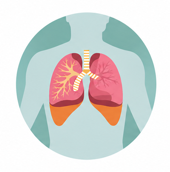 TB disease-severity spectrum — screening stage lungs with early tuberculosis foci, vibroacoustic biosignature illustration