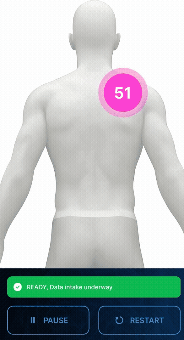 Posterior scan guidance on the imPulse UNA app