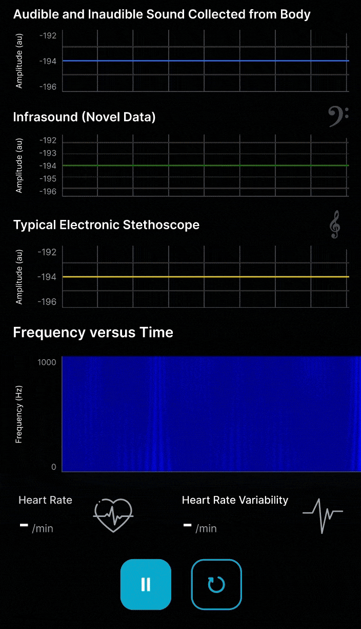 Live vibroacoustic signal capture