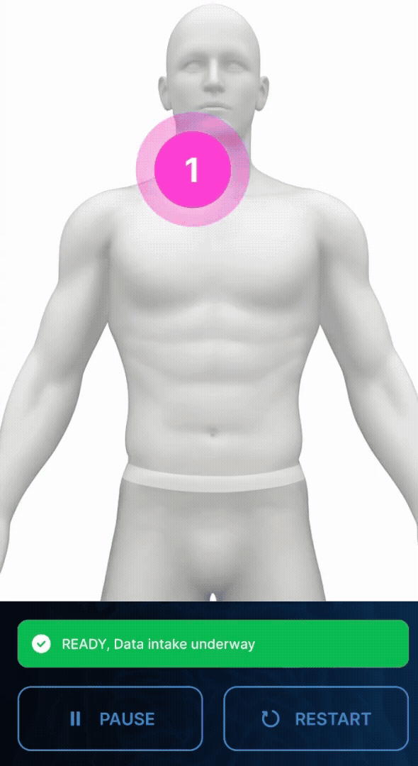 Anterior scan guidance on the imPulse UNA app
